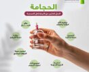 حجامة