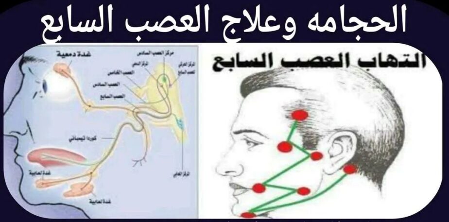 حجامة