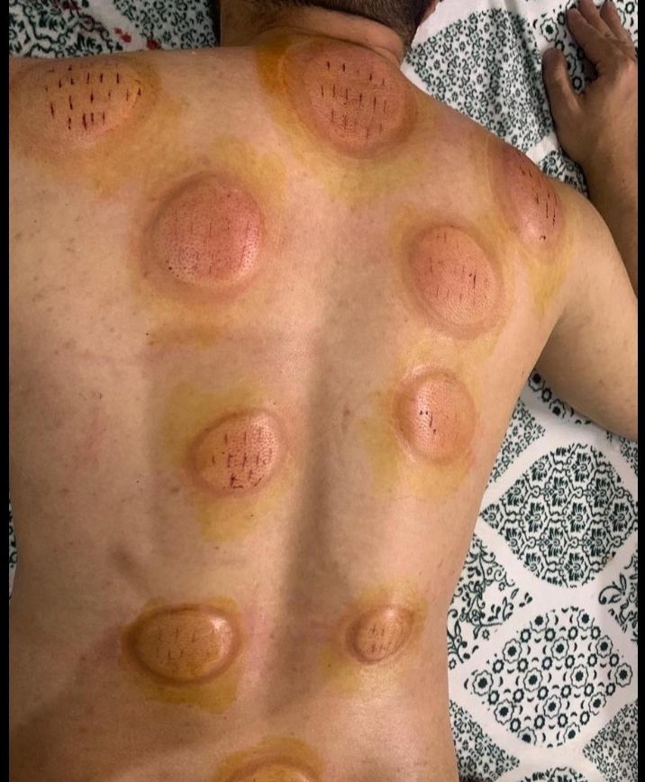 أبو عمر للحجامه