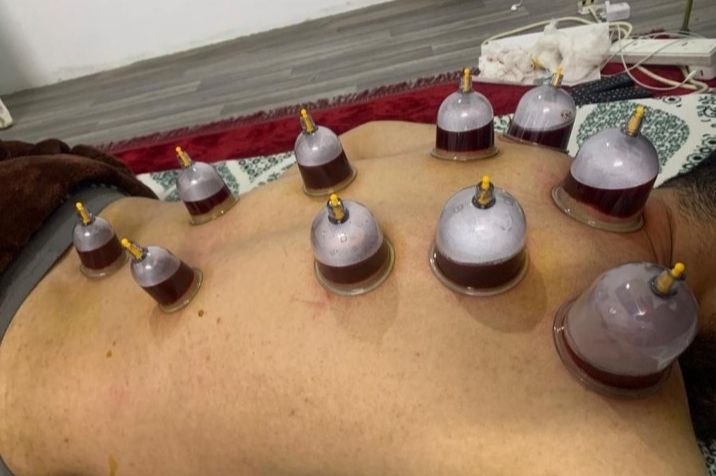 أبو عمر للحجامه