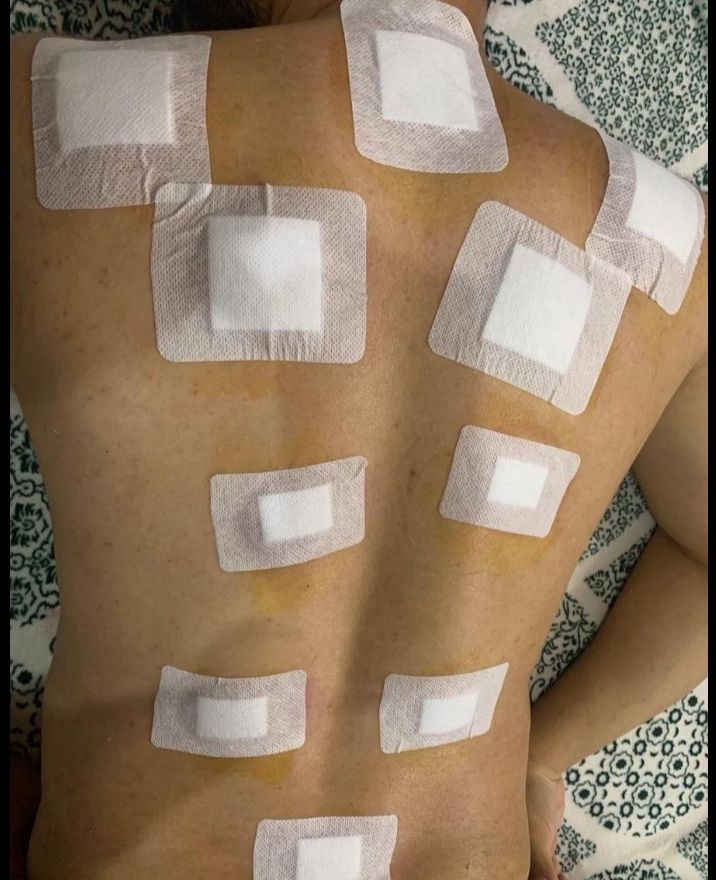 أبو عمر للحجامه