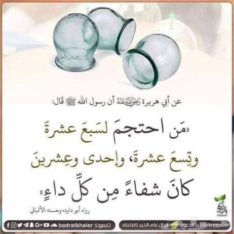 ال حجامة بالمدينة النبوية