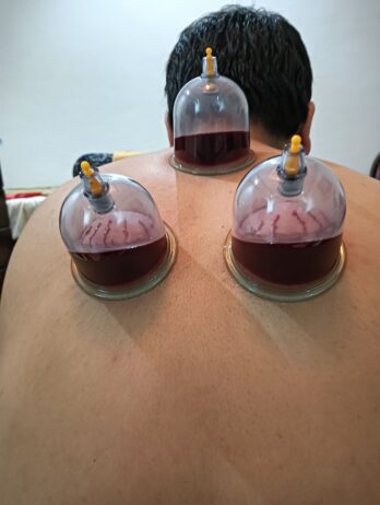 ال حجامة بالمدينة النبوية