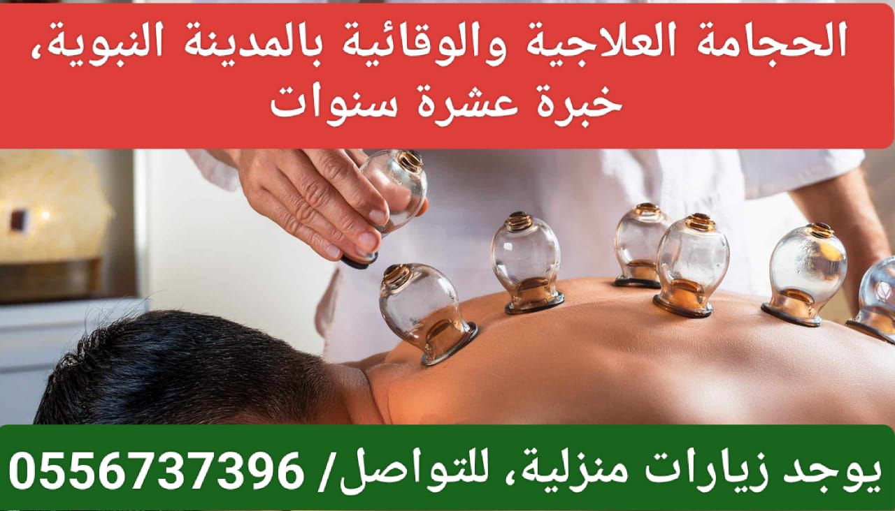 الحجامة العلاجية والوقائية بالمدينة النبوية خبرة ع